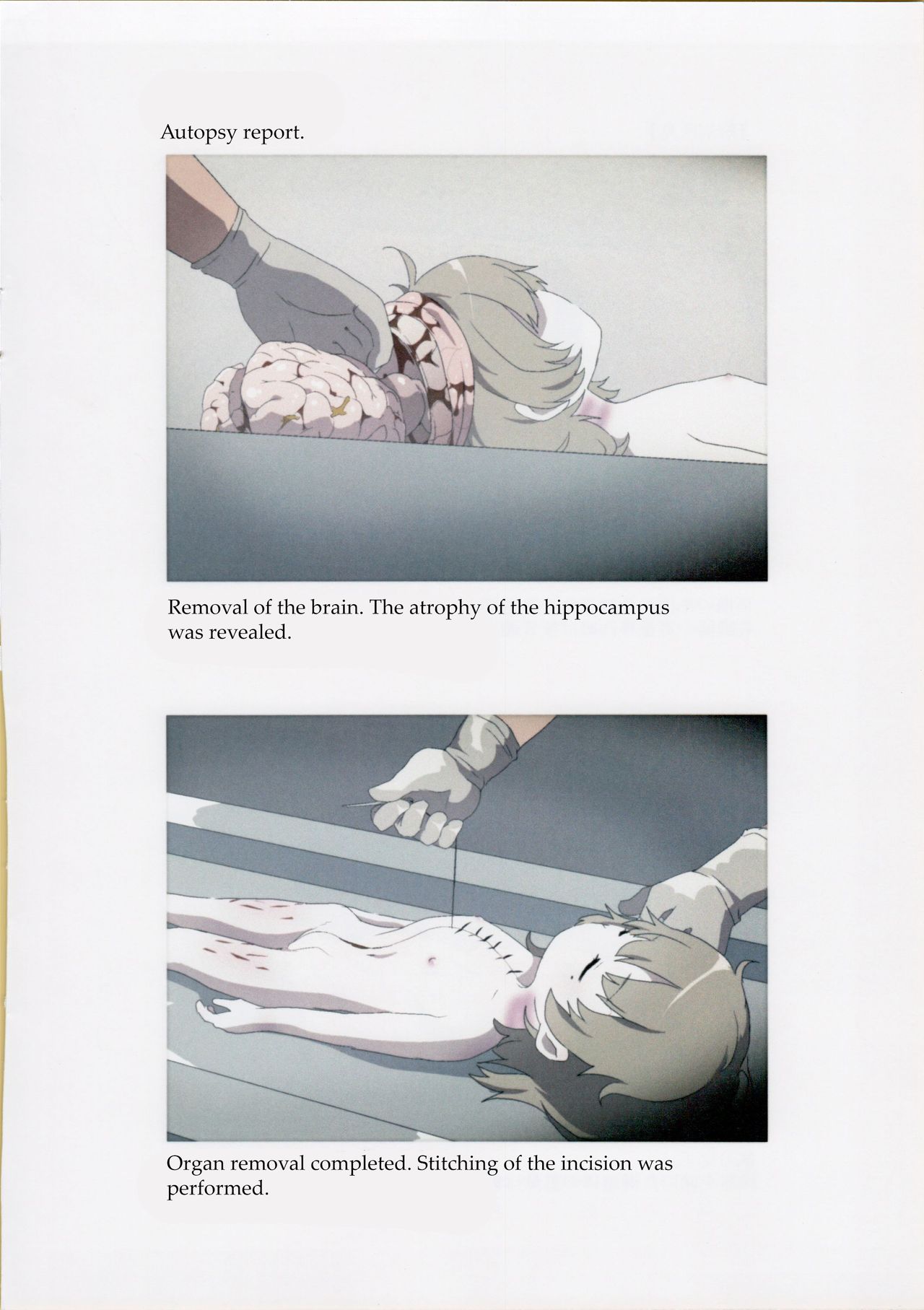 (C95) [02 (Harasaki)] Nishiogikubo Shoujo Satsugai Jiken Shihou Kaibou Kiroku | Nishi-Ogikubo Girl Murder Case Judicial Autopsy Report (Hatoba Tsugu) [English] page 9 full
