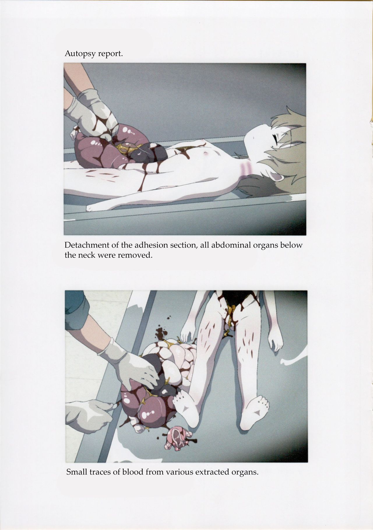 (C95) [02 (Harasaki)] Nishiogikubo Shoujo Satsugai Jiken Shihou Kaibou Kiroku | Nishi-Ogikubo Girl Murder Case Judicial Autopsy Report (Hatoba Tsugu) [English] page 8 full